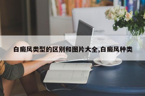 白癜风类型的区别和图片大全,白癜风种类