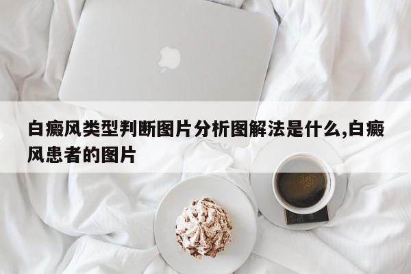 白癜风类型判断图片分析图解法是什么,白癜风患者的图片