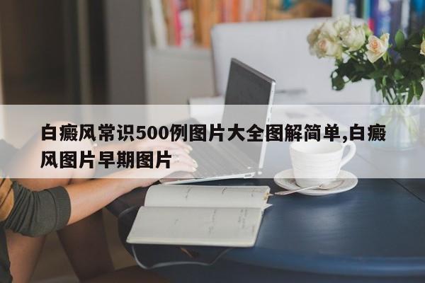 白癜风常识500例图片大全图解简单,白癜风图片早期图片