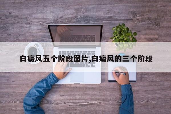白癜风五个阶段图片,白癜风的三个阶段