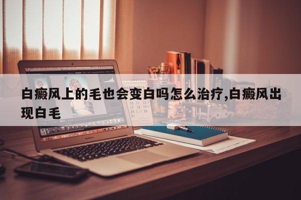 白癜风上的毛也会变白吗怎么治疗,白癜风出现白毛